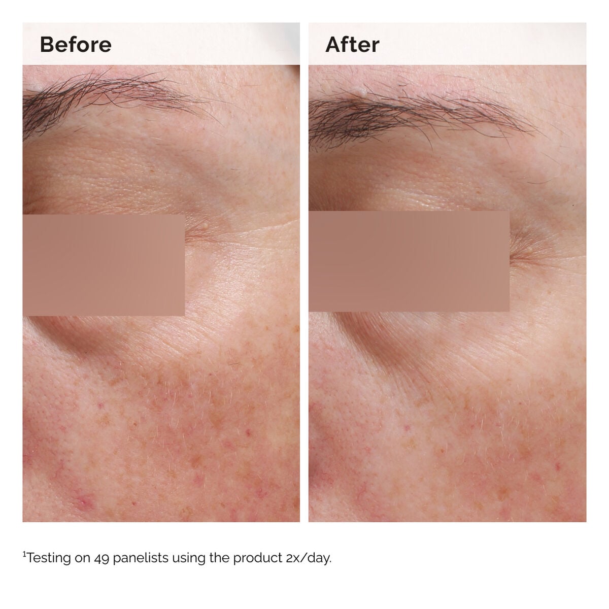 niacinamide-5-face-and-body-emulsion-c3 2024-08-23-ORD-Nia-5pct-Face-Body-B-A-Elasticity-Global-02-1x1.jpg