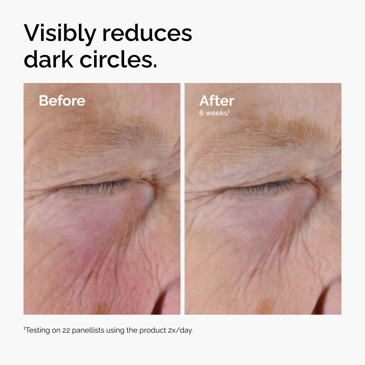 caffeine-solution-5-egcg-eye-serum-b5 ord-caffeine-solution-egcg-dark-circles-before-after.jpg