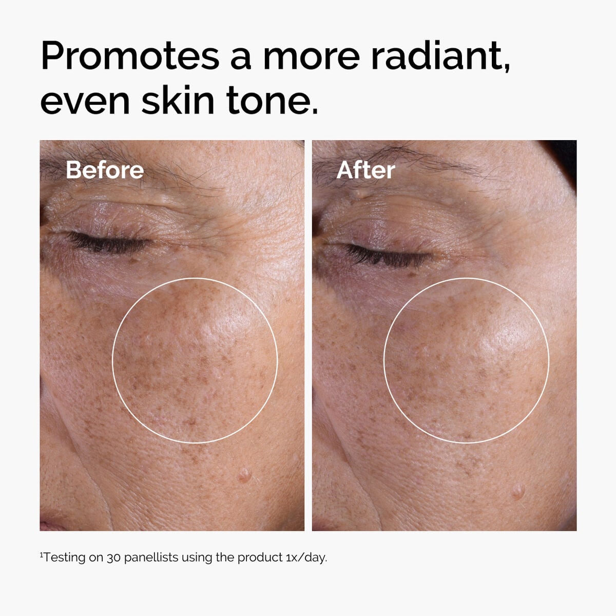 glycolic-acid-7-exfoliating-toner-p3 ord-glycolic-before-after-radiance.jpg