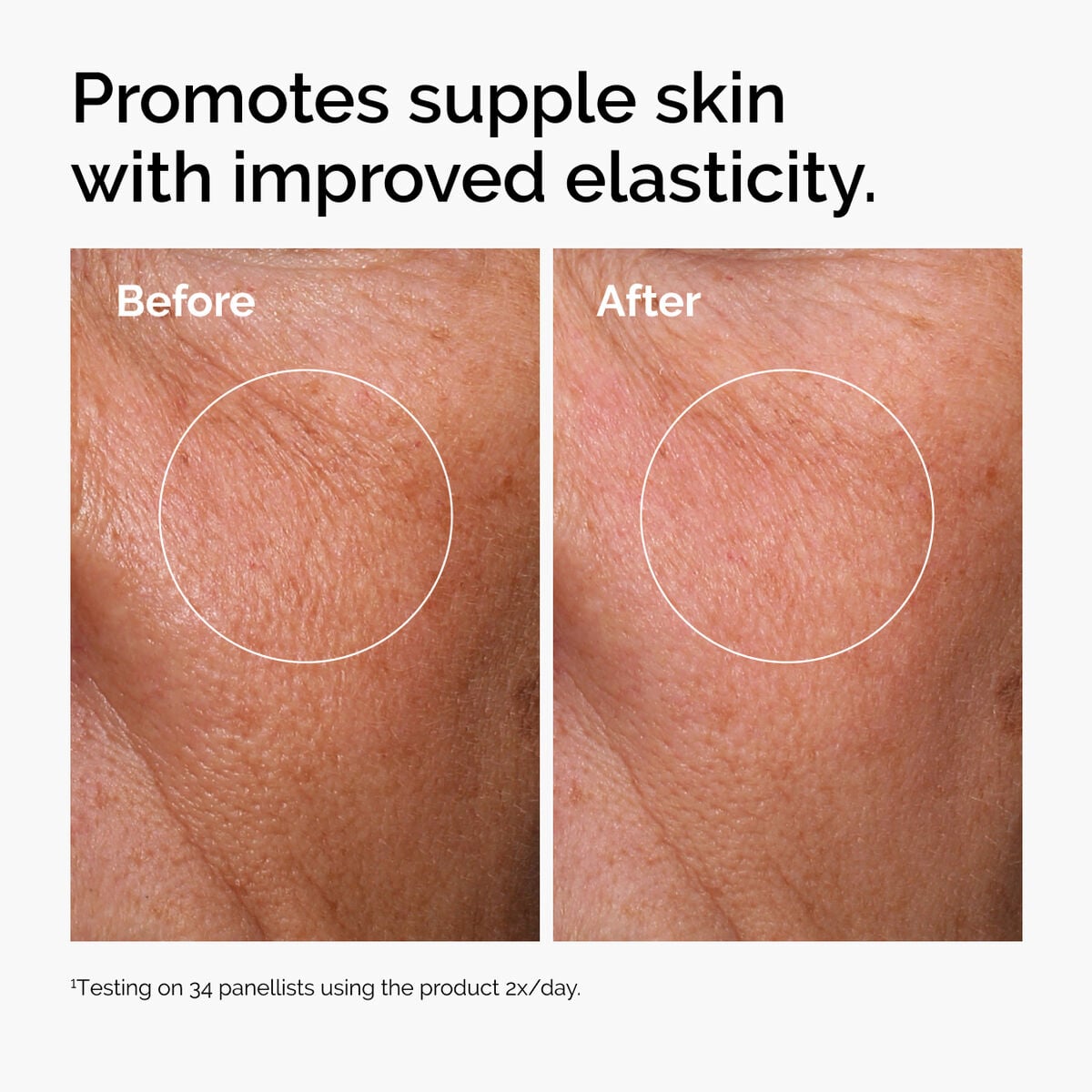 hyaluronic-acid-2-b5-with-ceramides-o2 ord-hyaluronic-acid-2pct-b5-hydrating-serum-before-after-elasticity.jpg