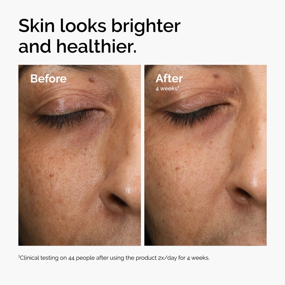 multi-antioxidant-radiance-serum-y3 ord-mars-before-after-healthy.jpg