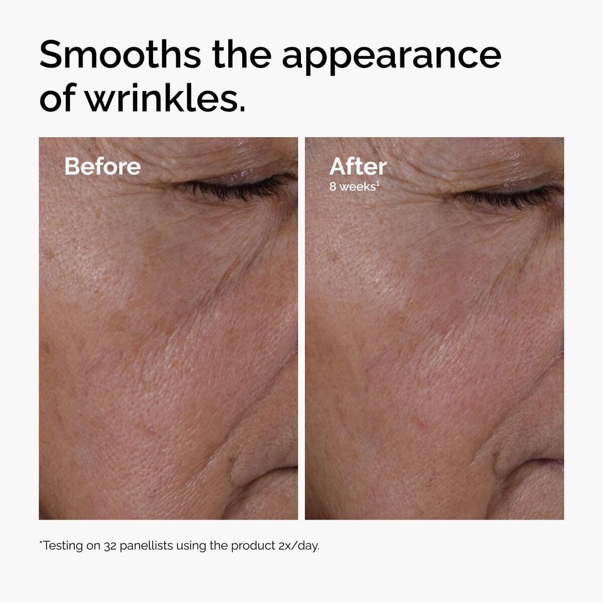 multi-peptide-ha-serum-y3 ord-multi-peptide-ha-serum-wrinkles-before-after.jpg
