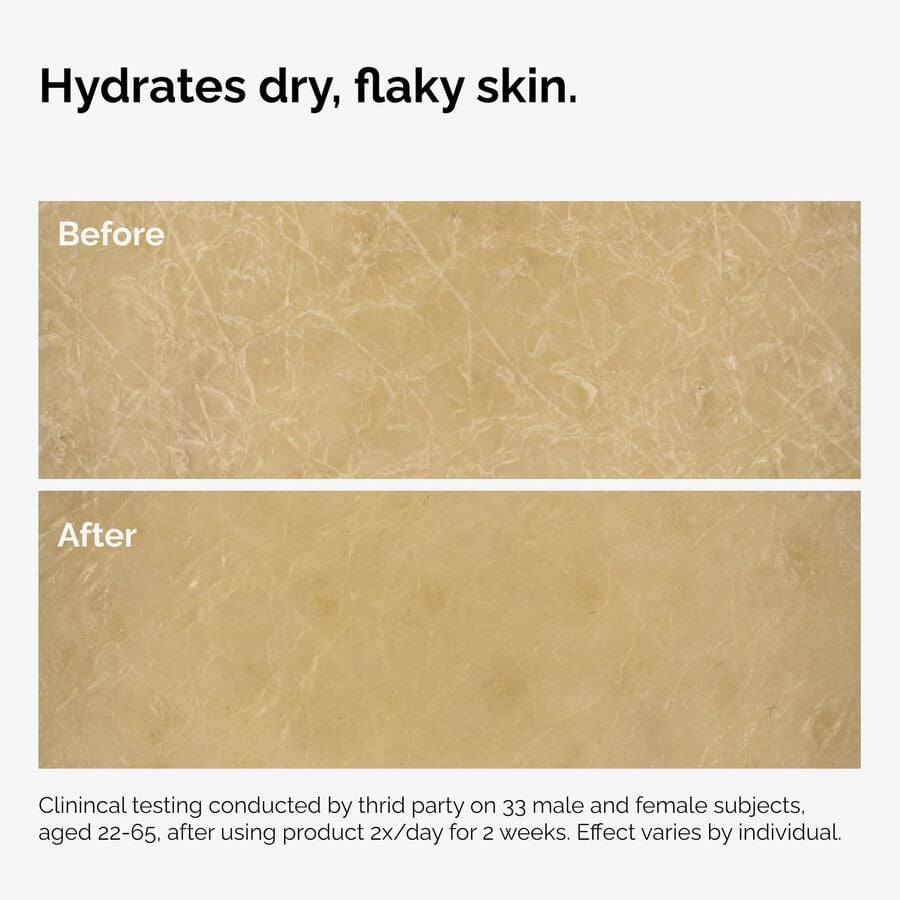 the-body-care-collection-s5 ord-natural-moisturizing-factors-inulin-body-before-after-graphic-02.jpg
