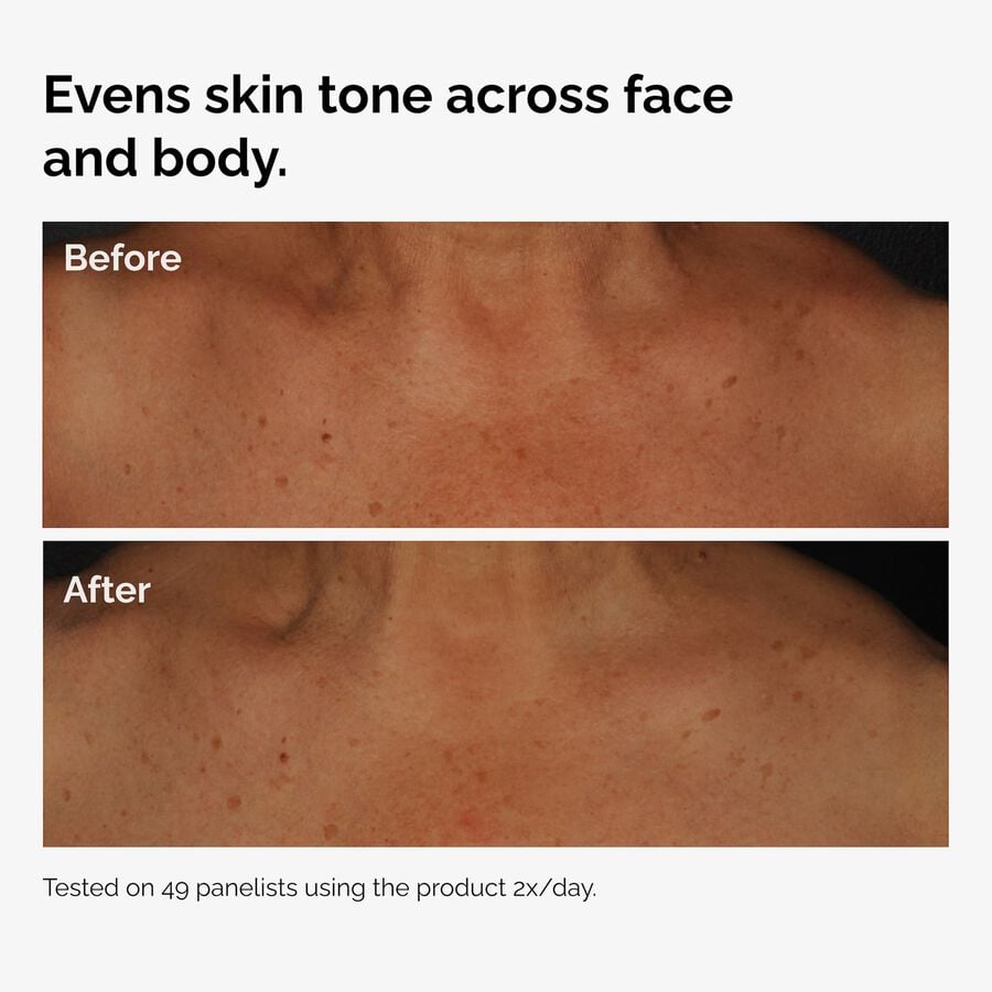the-body-care-collection-s5 ord-niacinamide-face-body-serum-before-after-even-tone-graphic.jpg