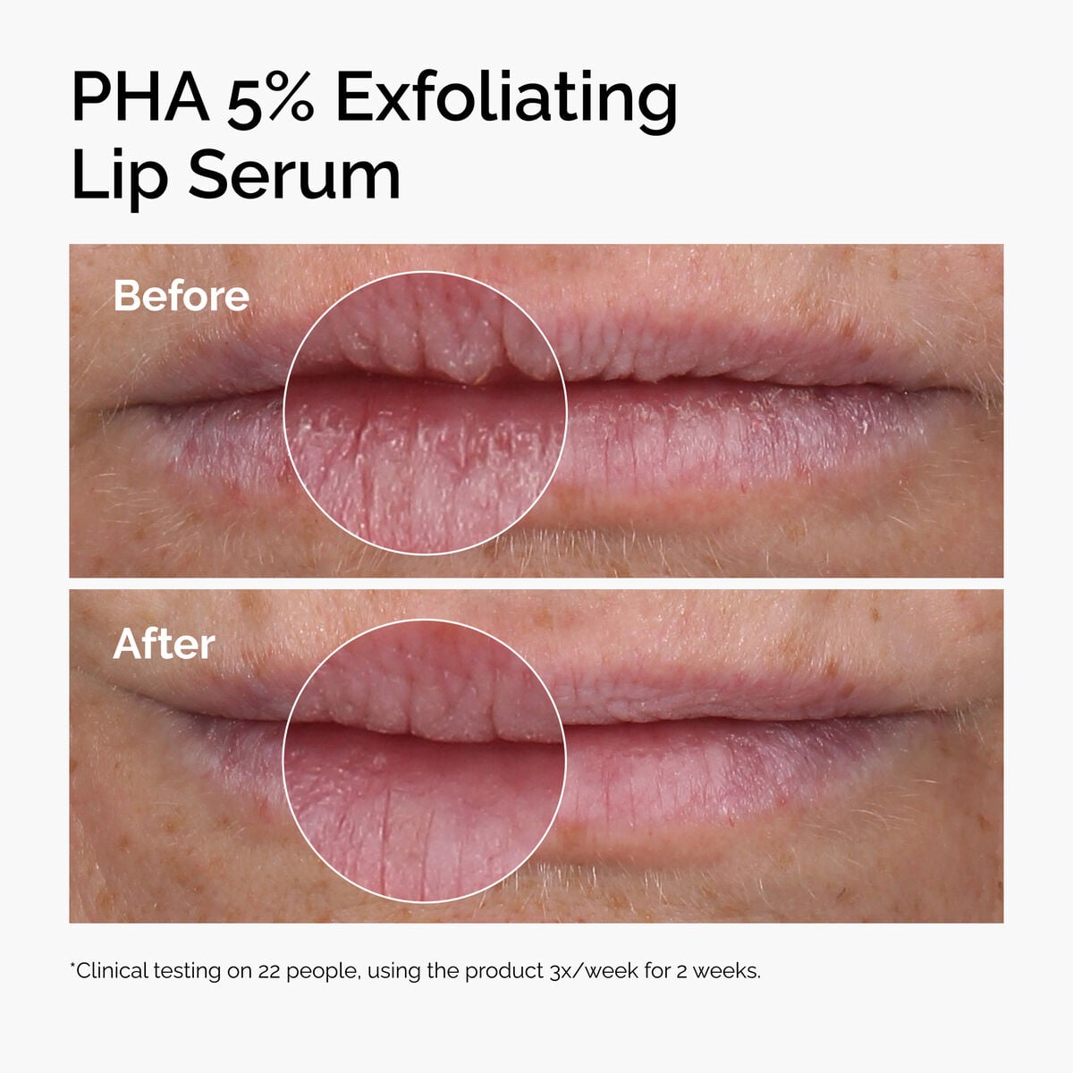 pha-5-exfoliating-lip-serum-e6 ord-pha-5pct-lip-exfoliating-serum-before-after.jpg